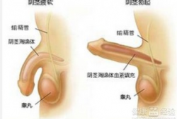 阴茎勃起硬度不够怎么办,提升阴茎勃起硬度的实用方法解析